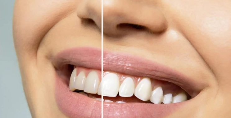 أفضل مركز تجميل الأسنان بالمدينة المنورة بخدمات حديثة