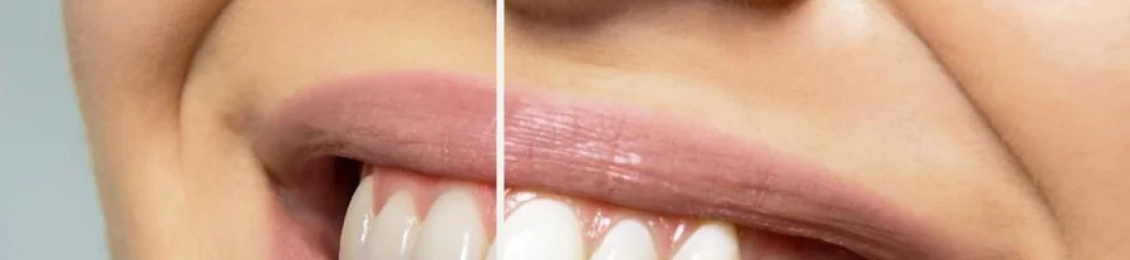 أفضل مركز تجميل الأسنان بالمدينة المنورة بخدمات حديثة