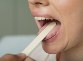 تحليل مسحة اللسان: متى يطلبه الطبيب وما الذي يكشفه؟