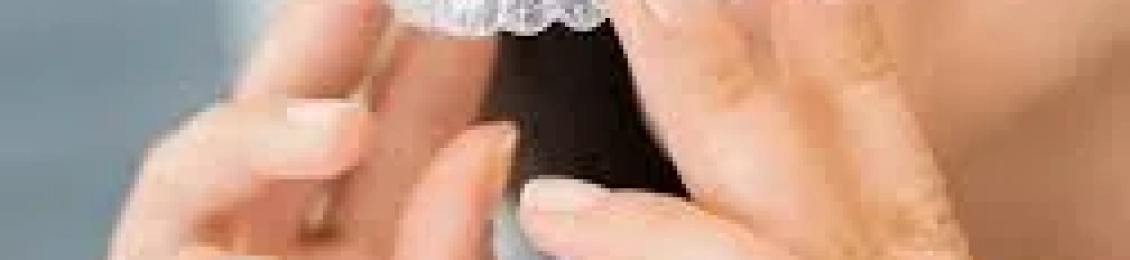 تجربتي مع التقويم الشفاف: مميزات وعيوب من واقع التجربة