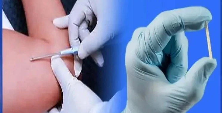 تجربتي مع شريحة منع الحمل: المميزات والآثار الجانبية