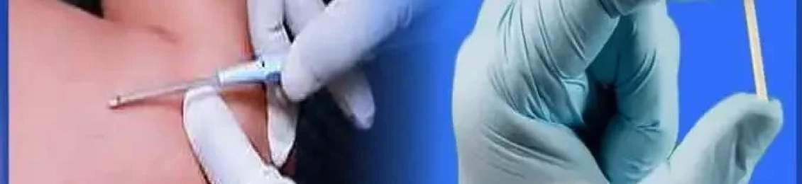 تجربتي مع شريحة منع الحمل: المميزات والآثار الجانبية