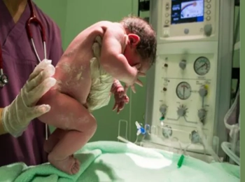 تجاربكم مع علامات قرب الولادة مع د.أُنس الشريف