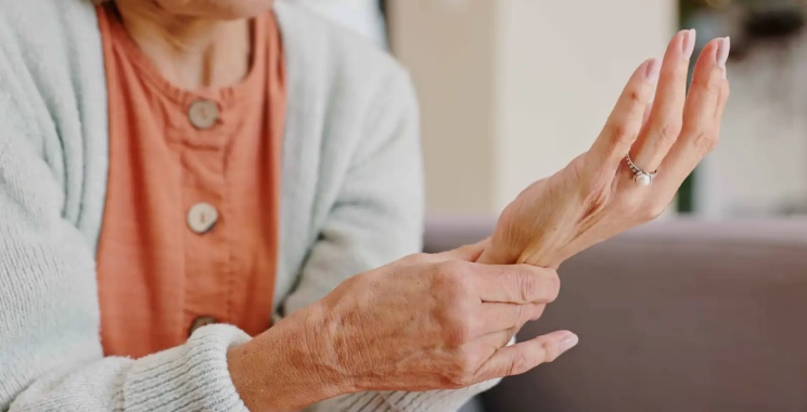 أسباب هشاشة العظام عند النساء وطرق الوقاية بعد سن الأربعين