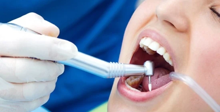 ما هي أسباب وجع الضرس بعد الحشو بفترة؟