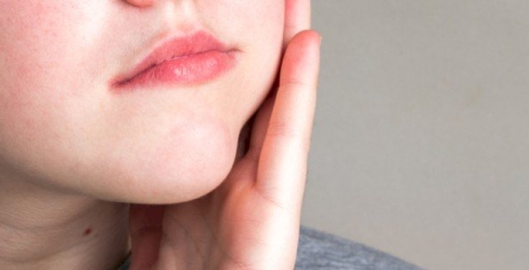 علاج ورم الضرس والخد: الأسباب وأفضل طرق العلاج في المنزل والعيادة