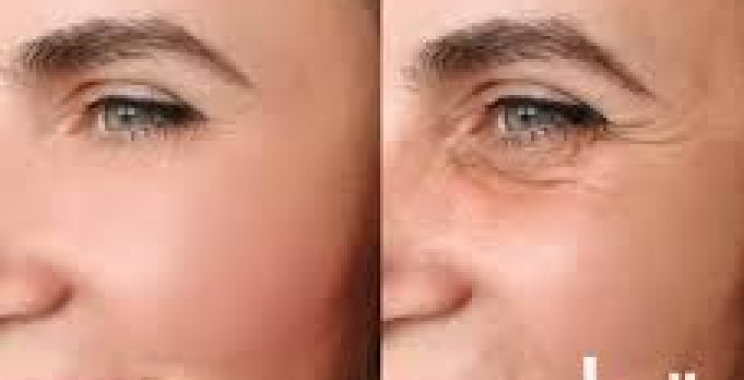 هل الوجه يرجع طبيعي بعد البوتكس؟ تعرفي على الإجابة