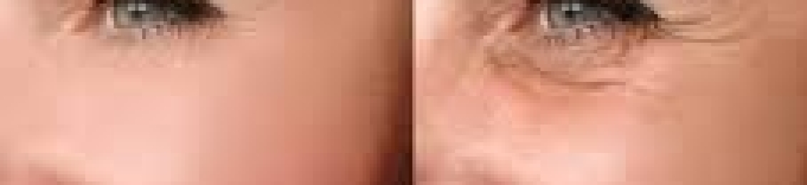 هل الوجه يرجع طبيعي بعد البوتكس؟ تعرفي على الإجابة