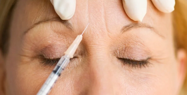 متى ينتهي مفعول البوتكس ومتى تحتاجين جلسة جديدة؟