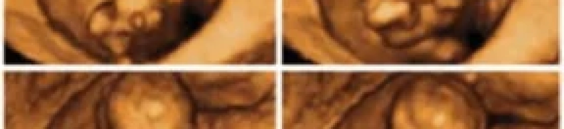 سونار الحمل ثلاثي الأبعاد بالمدينة المنورة: رؤية واضحة لجنينك
