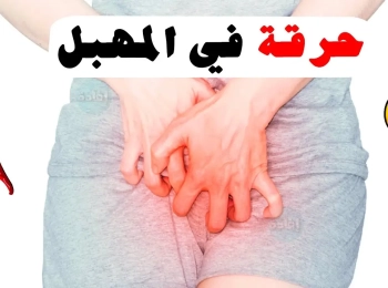 كيفية علاج حرقة المهبل والتخلص من الحكة؟