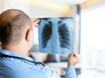 افضل دكتور اشعة صدر عادية في المدينة المنورة