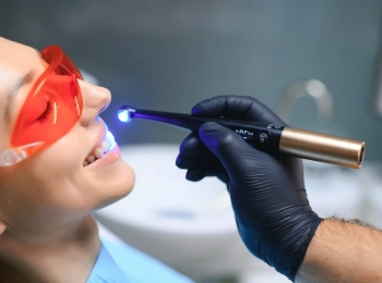 تلميع الاسنان بالعيادة وإزالة التصبغات بأحدث التقنيات