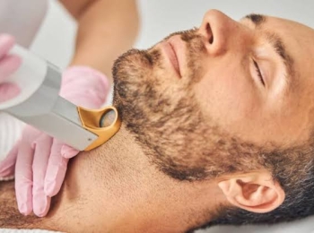 فوائد ليزر ازالة الشعر للرجال ونصائح قبل الليزر