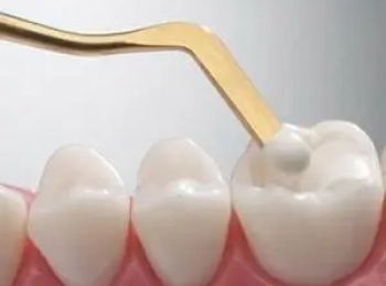 د.هالة افضل دكتورة في الحشوات التجميلية وعلاج عصب الأسنان