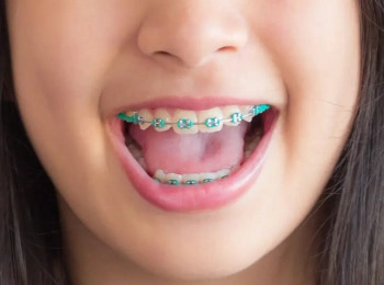 افضل طبيب اسنان اطفال ذو كفاءة وخبرة