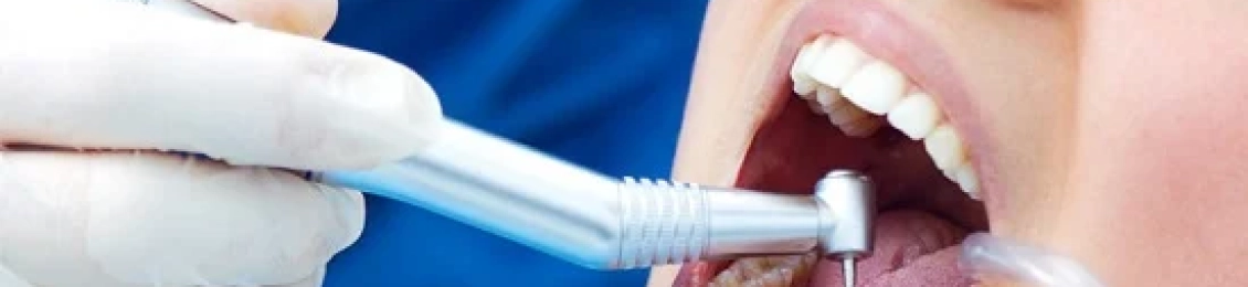 ما هي أسباب وجع الضرس بعد الحشو بفترة؟