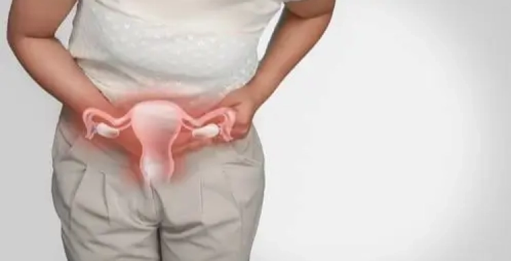 اهم أعراض الالتهابات النسائية الشديدة