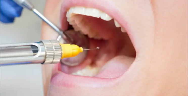 ما هي أنواع بنج الأسنان للاطفال؟ وكيف يختار الطبيب الأنسب؟