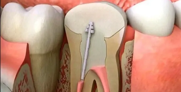 افضل اخصائي اعصاب اسنان في المدينة المنورة
