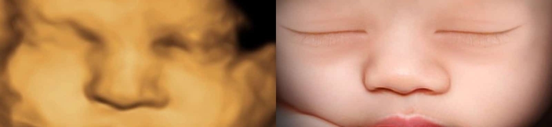 اشعة الدوبلر للجنين للاطمئنان على صحة طفلك بدقة أكبر