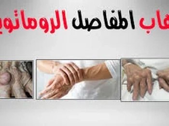 التهاب المفاصل الروماتويدي: الأسباب والأعراض والعلاج