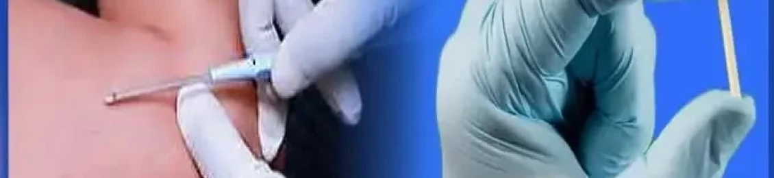 تجربتي مع شريحة منع الحمل: المميزات والآثار الجانبية