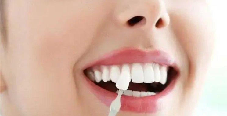 تركيبات الايماكس انواعها ومميزاتها