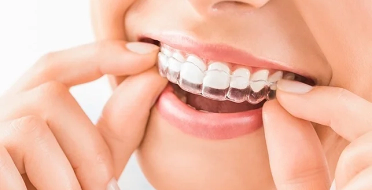 د. ابراهيم زيتوني افضل دكتور تقويم أسنان شفاف 