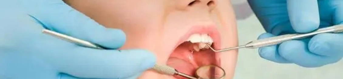 افضل حشوات اسنان الاطفال المناسبة