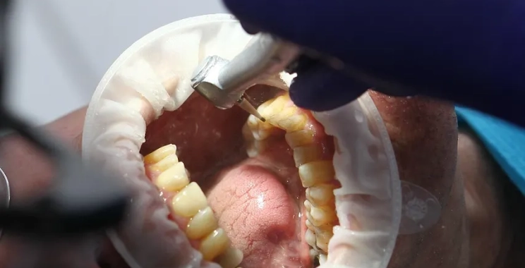 اهم خدمات عيادة تجميل اسنان في المدينة المنورة
