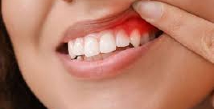 اسباب التهابات الاسنان وطرق علاجها في مجمع الطب المتميز