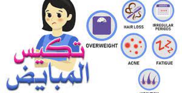 ما هي تكيس المبايض وكيفية الوقاية منها