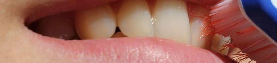 نصائح بعد تلميع الأسنان وأهم ممنوعات الطعام والشراب للحفاظ على أسنان بيضاء